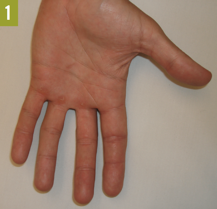 Collection of Conditions Affecting the Hands Consultant360